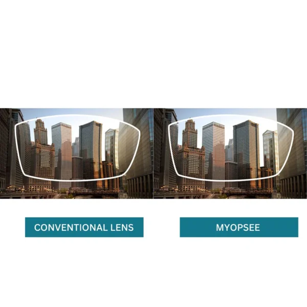 nikon myopsee das single vision lens